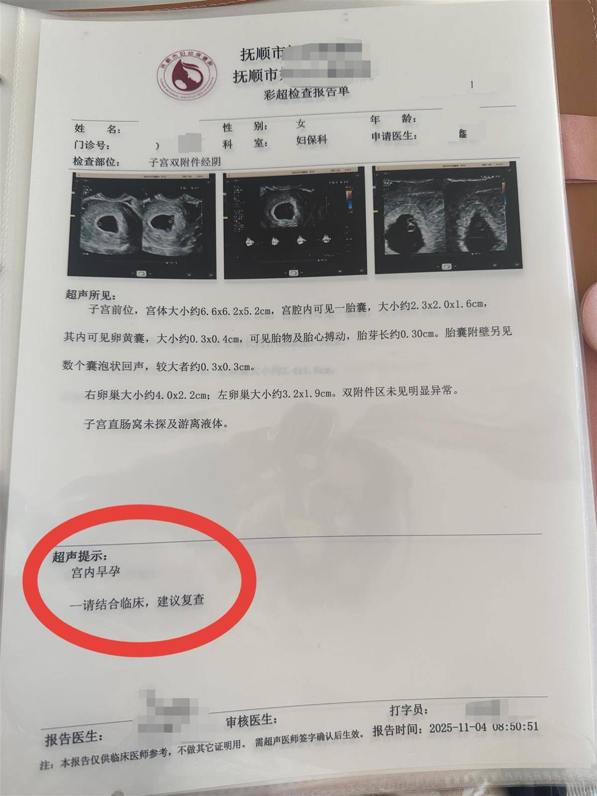 怎么开通皇冠信用开户_辽宁一孕妇两个月内从一胎变四胞胎怎么开通皇冠信用开户,每次产检发现多出一胎,医生:系同卵四胞胎,概率1300万至1500万分之一
