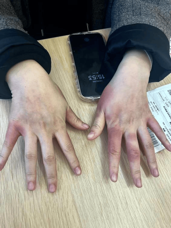 皇冠登录网址
_东北姑娘来浙江后崩溃了皇冠登录网址
,穿3条加绒裤还冻到发抖!南方人冬天怎么保命,网友吵翻!